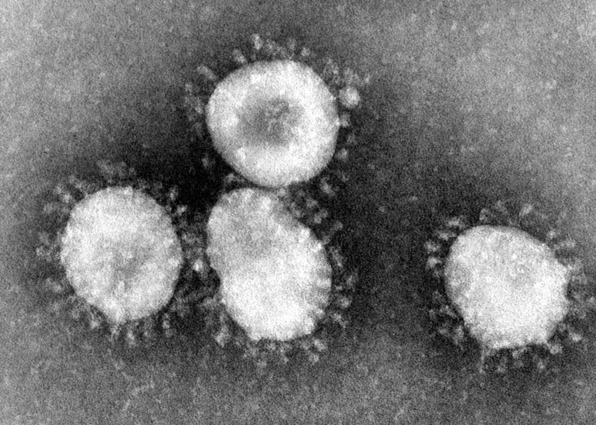 The Coronavirus and the Urgent Need to Redefine National Security